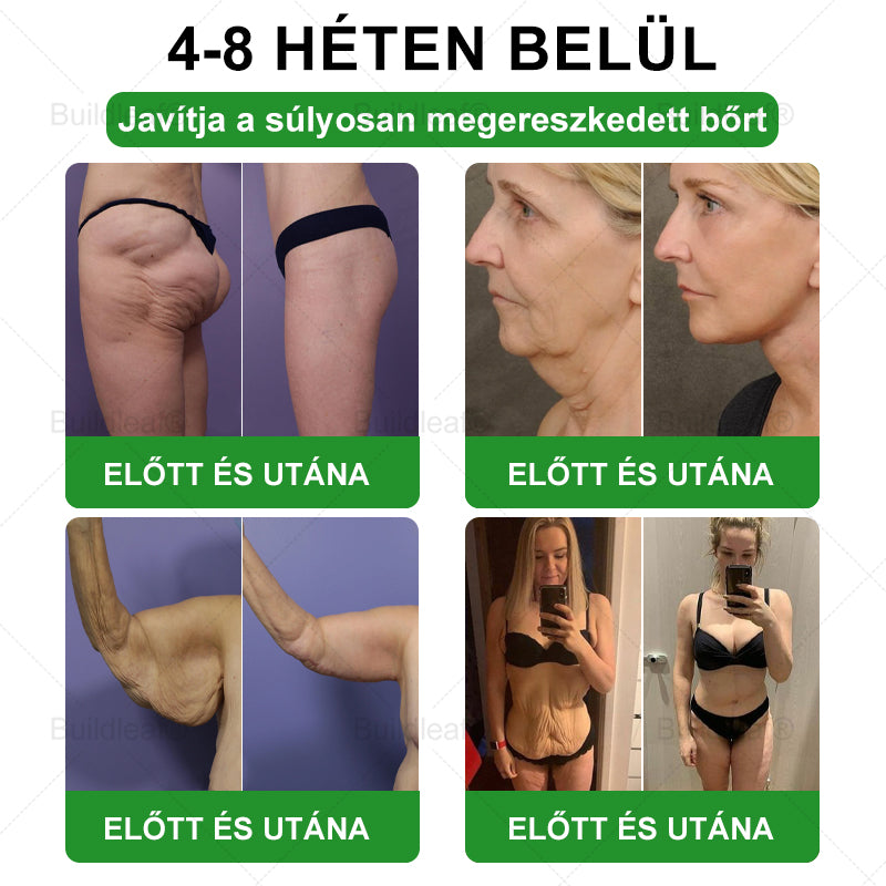 🎁 Már csak 5 doboz maradt! További 50% kedvezményt kínálunk! Legyen formában és egészséges. Fogyjon most, mert jövő évig nem lesz másik lehetőség!