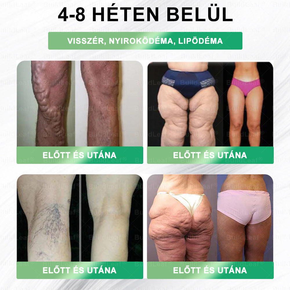 BuildLeaf®🛒 GLP-1 8-az-1-ben Fit & Vital Orális Oldat (Csak napi egyszer, látható változások 7 nap alatt) Elhízásra, szív- és érrendszeri egészségre, cukorbetegségre, alvási apnoéra, emésztőrendszeri egészségre, ízületi problémákra és még sok másra