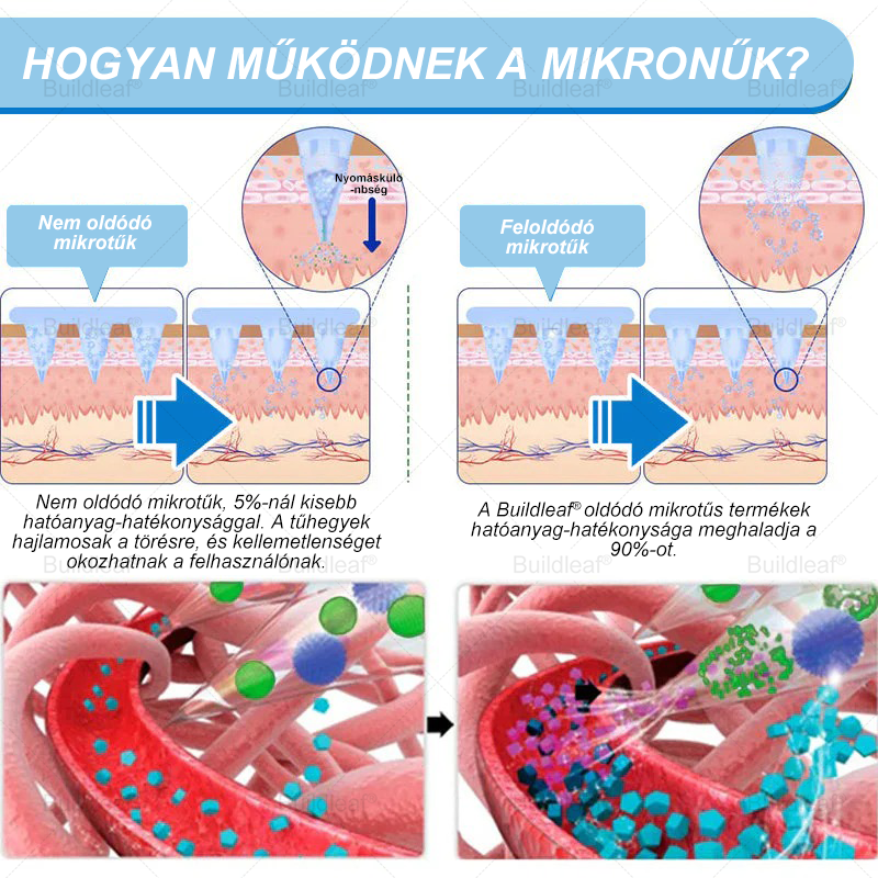 FDA Store | 𝐵uil𝗱𝐿ea𝐟® GLP-1 Slim & Firm Nano Microneedle Patch kollagénnel, kurkumával és Matrixyl 3000-rel | Elhízás, szív- és érrendszeri betegségek, cukorbetegség, alvási apnoe, ízületi problémák és egyéb állapotok kezelésére