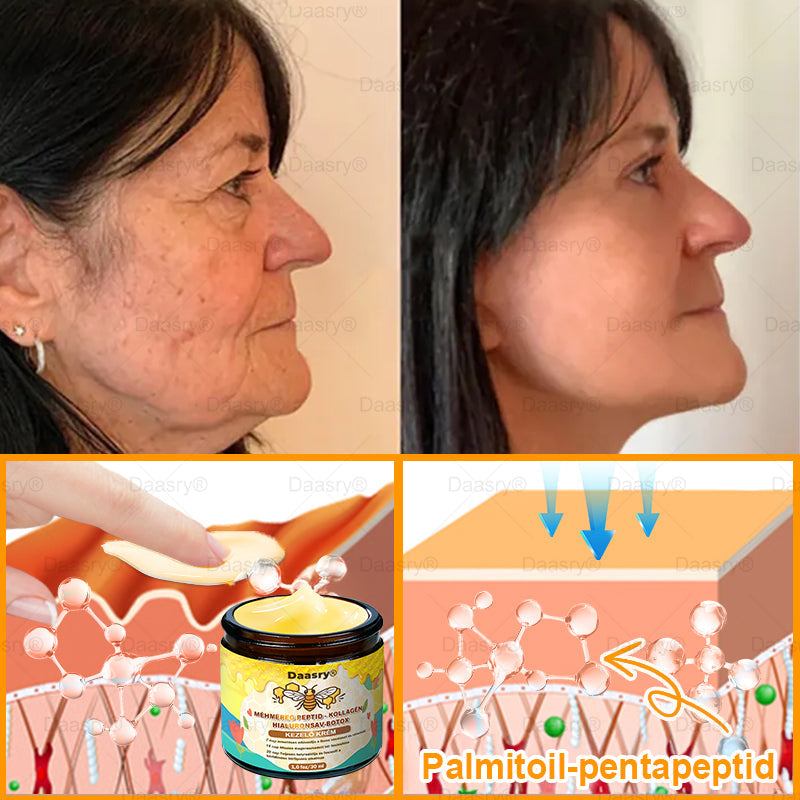 Daasry® Méhméreg Kezelő Krém, méhméreg peptidekkel, botulinum toxinnal, hialuronsavval és kollagénnel💧. Hatékonyan küzd a ráncok, finom vonalak, megereszkedés, terhességi csíkok és sötét foltok ellen — feszesítés, emelés és kiemelkedő eredmények!