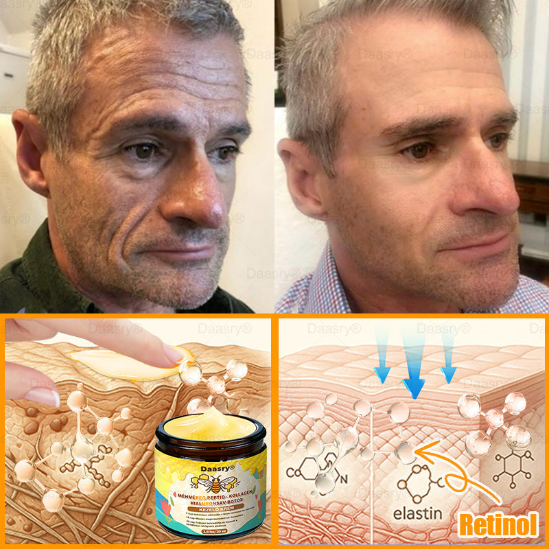 Daasry® Méhméreg Kezelő Krém, méhméreg peptidekkel, botulinum toxinnal, hialuronsavval és kollagénnel💧. Hatékonyan küzd a ráncok, finom vonalak, megereszkedés, terhességi csíkok és sötét foltok ellen — feszesítés, emelés és kiemelkedő eredmények!