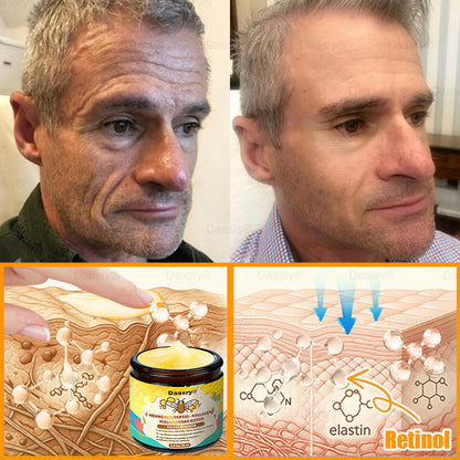 Daasry® Méhméreg Kezelő Krém, méhméreg peptidekkel, botulinum toxinnal, hialuronsavval és kollagénnel💧. Hatékonyan küzd a ráncok, finom vonalak, megereszkedés, terhességi csíkok és sötét foltok ellen — feszesítés, emelés és kiemelkedő eredmények!