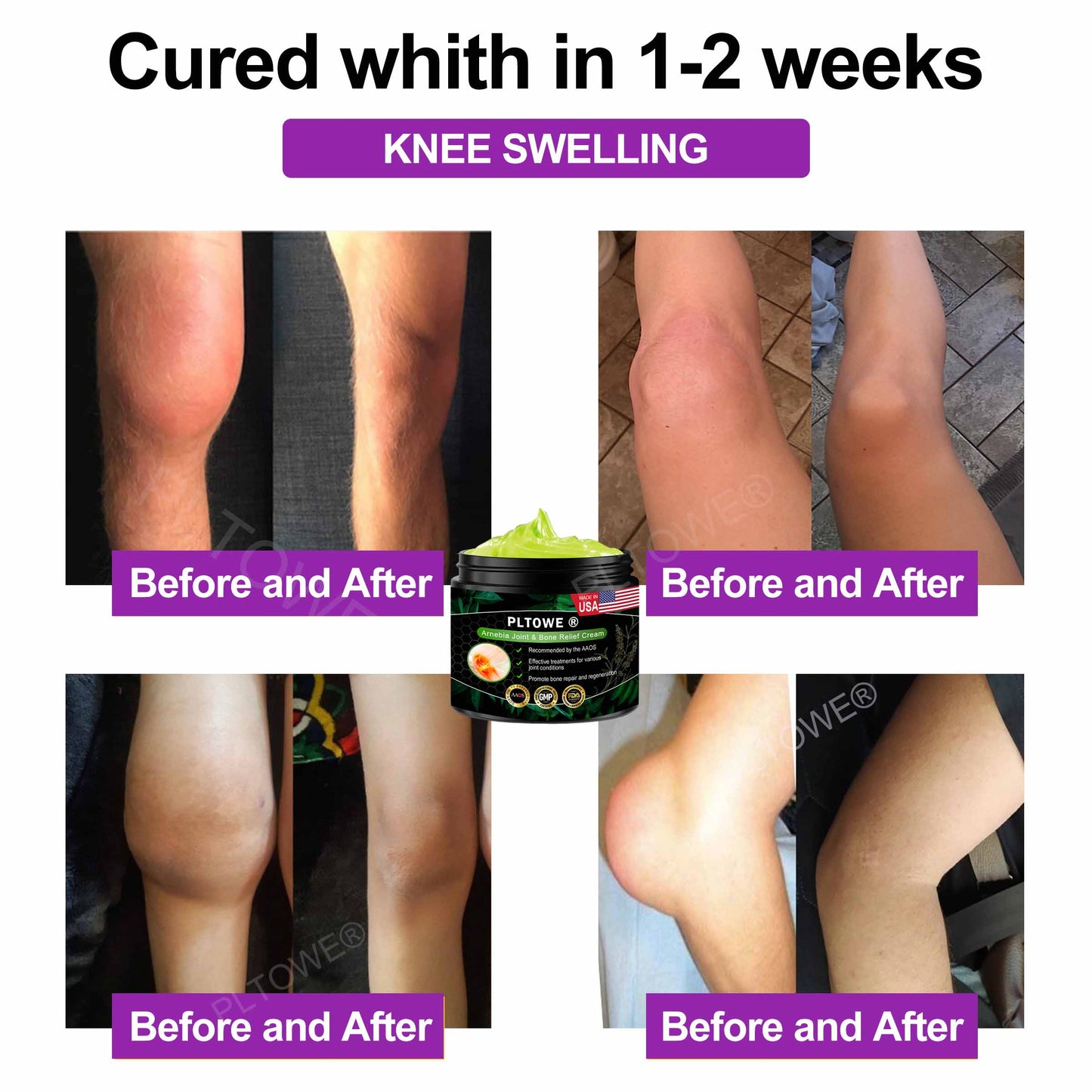 PLTOWE® Arnebia Joint and Bone Relief Cream(AAOS Recommends)