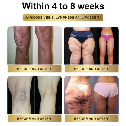 Mayo Clinic Recommended | 🎉🎉Official Store |TOOYES® MetaBoost GLP-1 Herbal Oral Liquid