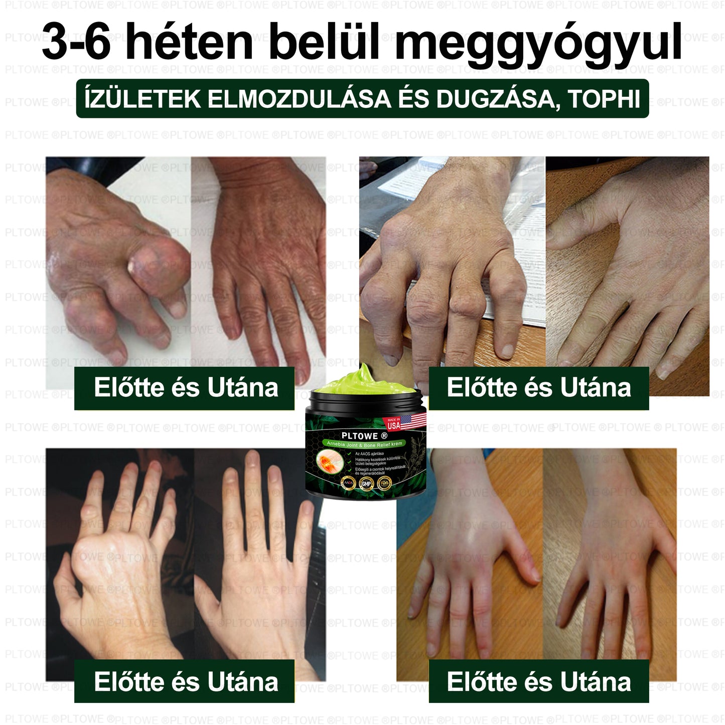 PLTOWE® Arnebia Ízületi és Csontfájdalom Enyhítő Krém (AAOS ajánlja)