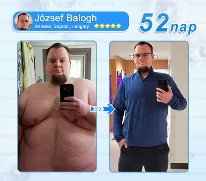 FDA Store | 𝐵uil𝗱𝐿ea𝐟® GLP-1 Slim & Firm Nano Microneedle Patch kollagénnel, kurkumával és Matrixyl 3000-rel | Elhízás, szív- és érrendszeri betegségek, cukorbetegség, alvási apnoe, ízületi problémák és egyéb állapotok kezelésére