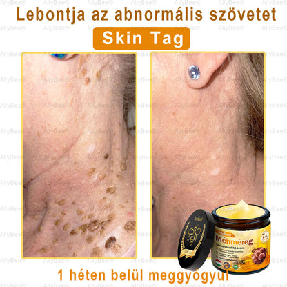 Mayo tisztviselő: AllyBee® bőrkezelő krém öregedésgátló, hidratáló, bőrjavító, egyenletes tónus, pattanások és sötét foltok kezelése, szemölcs és anyajegy eltávolítása, pikkelysömör enyhítése