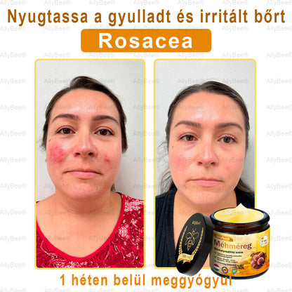 Mayo tisztviselő: AllyBee® bőrkezelő krém öregedésgátló, hidratáló, bőrjavító, egyenletes tónus, pattanások és sötét foltok kezelése, szemölcs és anyajegy eltávolítása, pikkelysömör enyhítése