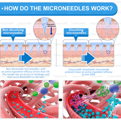 "Made & Shipped from Australia | Clinically Proven:CrazyLeaf® SMGT-GLP-1 Nano Microneedle Patch with Collagen & Matrixyl 3000 | Obesity,Cardiovascular Diseas, Diabetes, Sleep Apnea, Joint Problems and More"