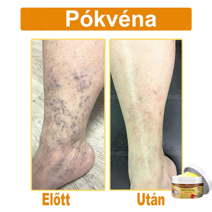 BSWELL® Méhméreg átfogó krém 🌿 AAD jóváhagyott és ajánlott