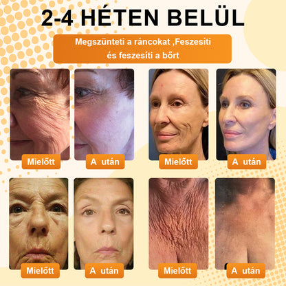 BSWELL® AgeDefy BeeSculpt Feszesítő Krém