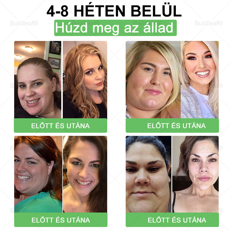 🎁 Már csak 5 doboz maradt! További 50% kedvezményt kínálunk! Legyen formában és egészséges. Fogyjon most, mert jövő évig nem lesz másik lehetőség!