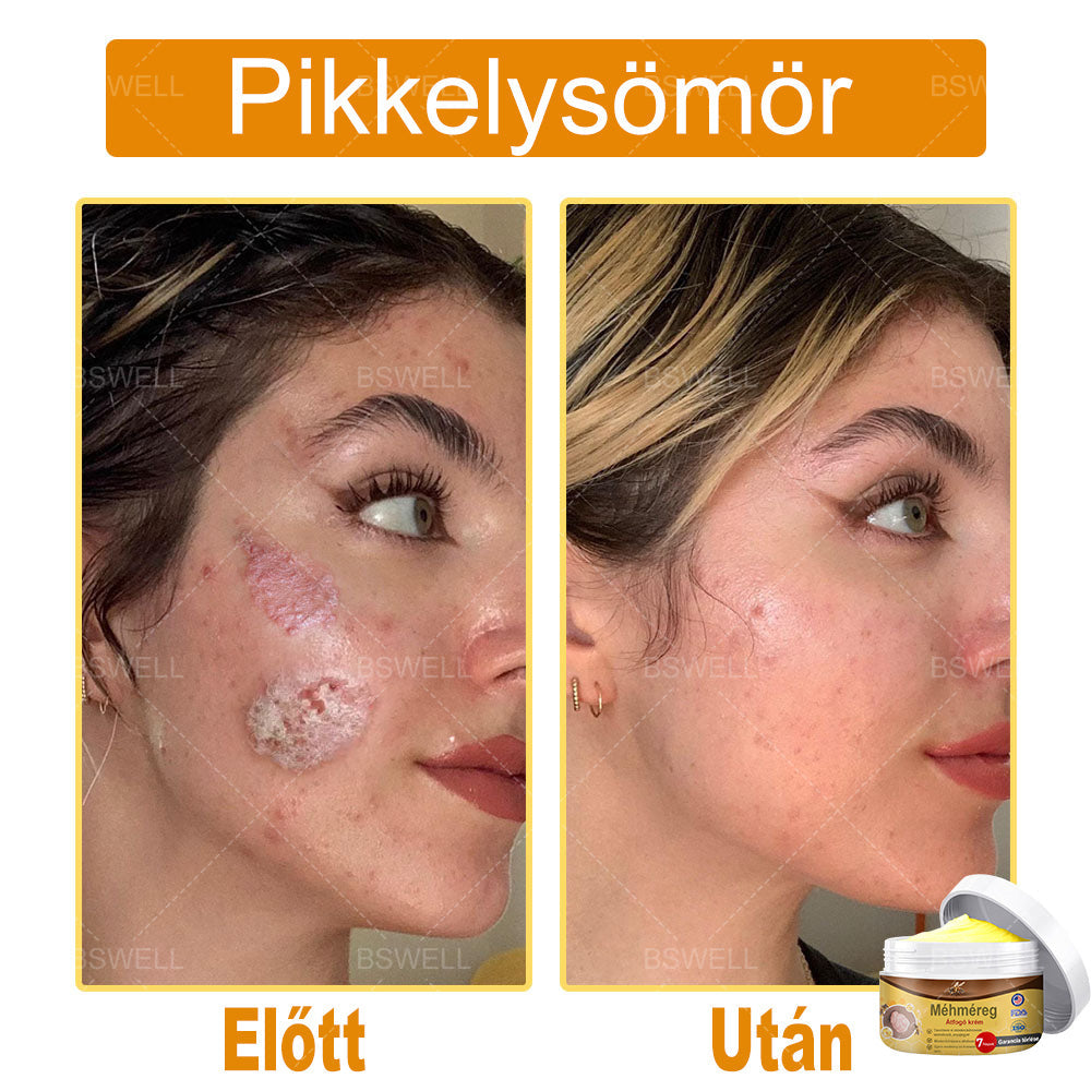 BSWELL® Méhméreg átfogó krém 🌿 AAD jóváhagyott és ajánlott