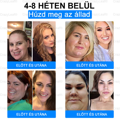 A Pécsi Tudományegyetem ajánlásával – Vezető GLP-1 tapasz Magyarországon CrazyLeaf® Nano Mikrotűs Tapasz SMGT-GLP-1 + Kollagén + Matrixyl 3000 Zsírégetés • Bőrfeszesítés • Vércukor-egyensúly • 7 nap alatt látható eredmény • Injekció nélkül