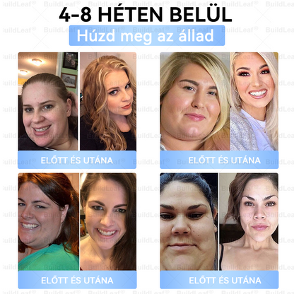 EU CE-minősítésse | 𝐵uil𝗱𝐿ea𝐟® GLP-1 Slim & Firm Nano Mikrotűs tapasz kollagénnel, kurkumával és Matrixyl 3000-rel | Elhízás, szív- és érrendszeri betegségek, cukorbetegség, alvási apnoe, ízületi problémák és egyéb állapotok kezelésére