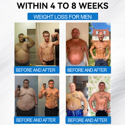 "Made & Shipped from Australia | Clinically Proven:CrazyLeaf® SMGT-GLP-1 Nano Microneedle Patch with Collagen & Matrixyl 3000 | Obesity,Cardiovascular Diseas, Diabetes, Sleep Apnea, Joint Problems and More"