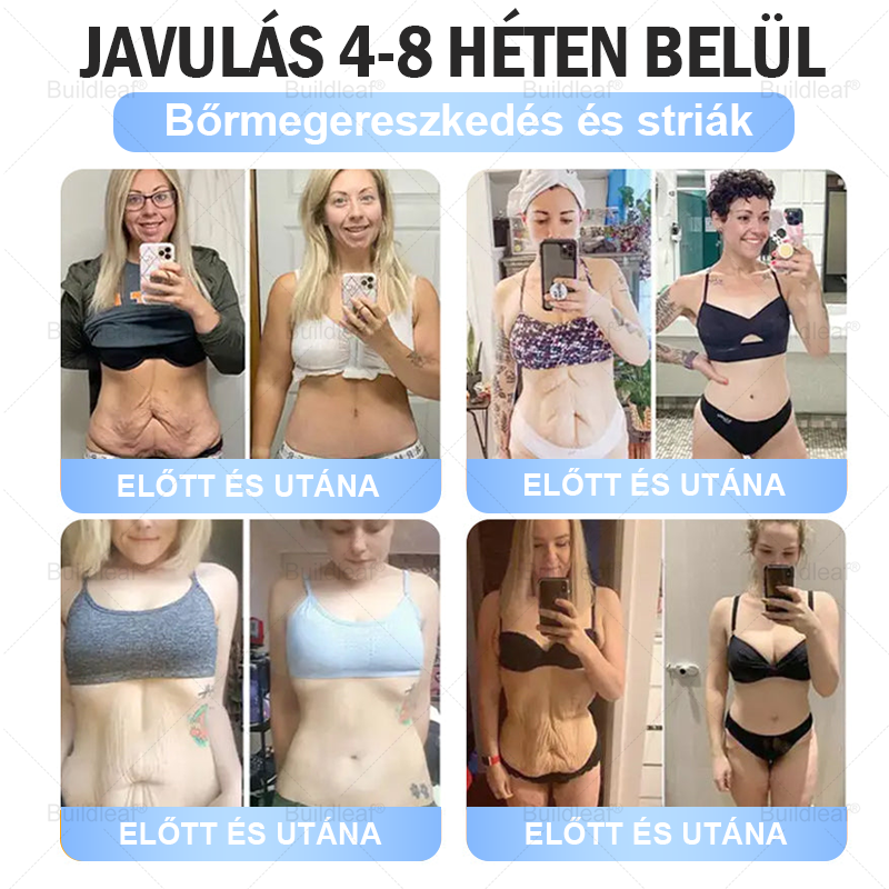 FDA Store | 𝐵uil𝗱𝐿ea𝐟® GLP-1 Slim & Firm Nano Microneedle Patch kollagénnel, kurkumával és Matrixyl 3000-rel | Elhízás, szív- és érrendszeri betegségek, cukorbetegség, alvási apnoe, ízületi problémák és egyéb állapotok kezelésére