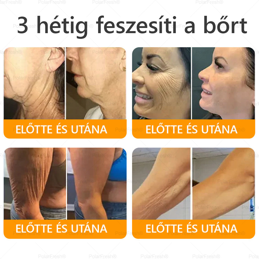 Daasry® Méhméreg Kezelő Krém, méhméreg peptidekkel, botulinum toxinnal, hialuronsavval és kollagénnel💧. Hatékonyan küzd a ráncok, finom vonalak, megereszkedés, terhességi csíkok és sötét foltok ellen — feszesítés, emelés és kiemelkedő eredmények!