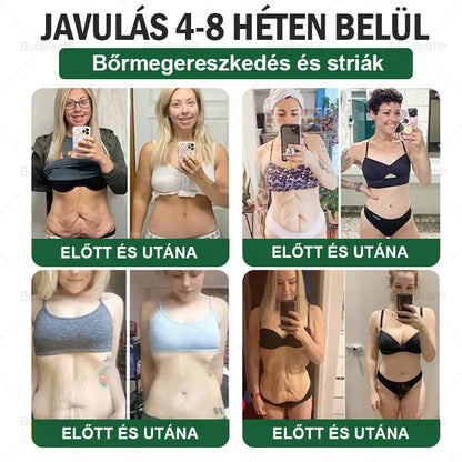 🎁 Már csak 5 doboz maradt! További 50% kedvezményt kínálunk! Legyen formában és egészséges. Fogyjon most, mert jövő évig nem lesz másik lehetőség!
