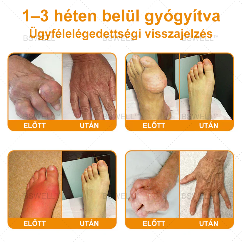 Lidocain Fájdalomcsillapító Roll-On Gélt(csökkenti az ízületi duzzanatot, fájdalmat, merevséget, bőrpírt, melegséget, fájdalmat és ízületi fáradtságot ), 4% Lidocain, Glükozamin, MSM, Arnica, Chondroitin, K2-vitamin