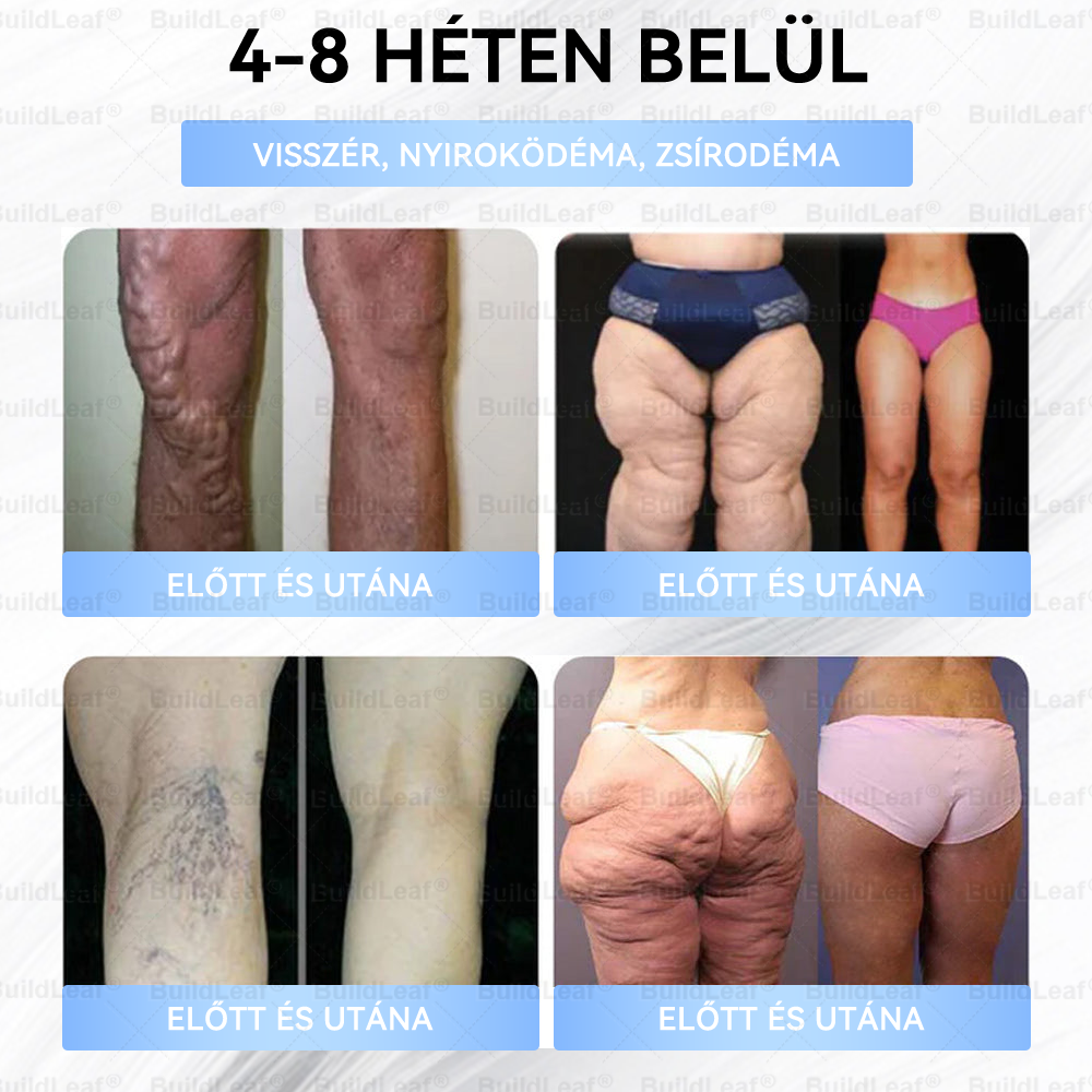 FDA Store | 𝐵uil𝗱𝐿ea𝐟® GLP-1 Slim & Firm Nano Microneedle Patch kollagénnel, kurkumával és Matrixyl 3000-rel | Elhízás, szív- és érrendszeri betegségek, cukorbetegség, alvási apnoe, ízületi problémák és egyéb állapotok kezelésére