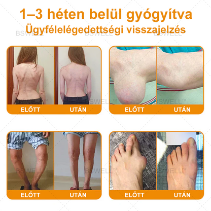 Lidocain Fájdalomcsillapító Roll-On Gélt(csökkenti az ízületi duzzanatot, fájdalmat, merevséget, bőrpírt, melegséget, fájdalmat és ízületi fáradtságot ), 4% Lidocain, Glükozamin, MSM, Arnica, Chondroitin, K2-vitamin