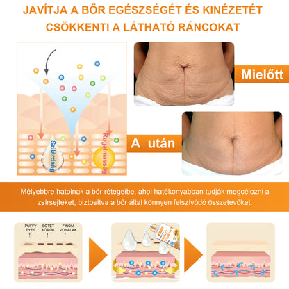 BSWELL® AgeDefy BeeSculpt Feszesítő Krém