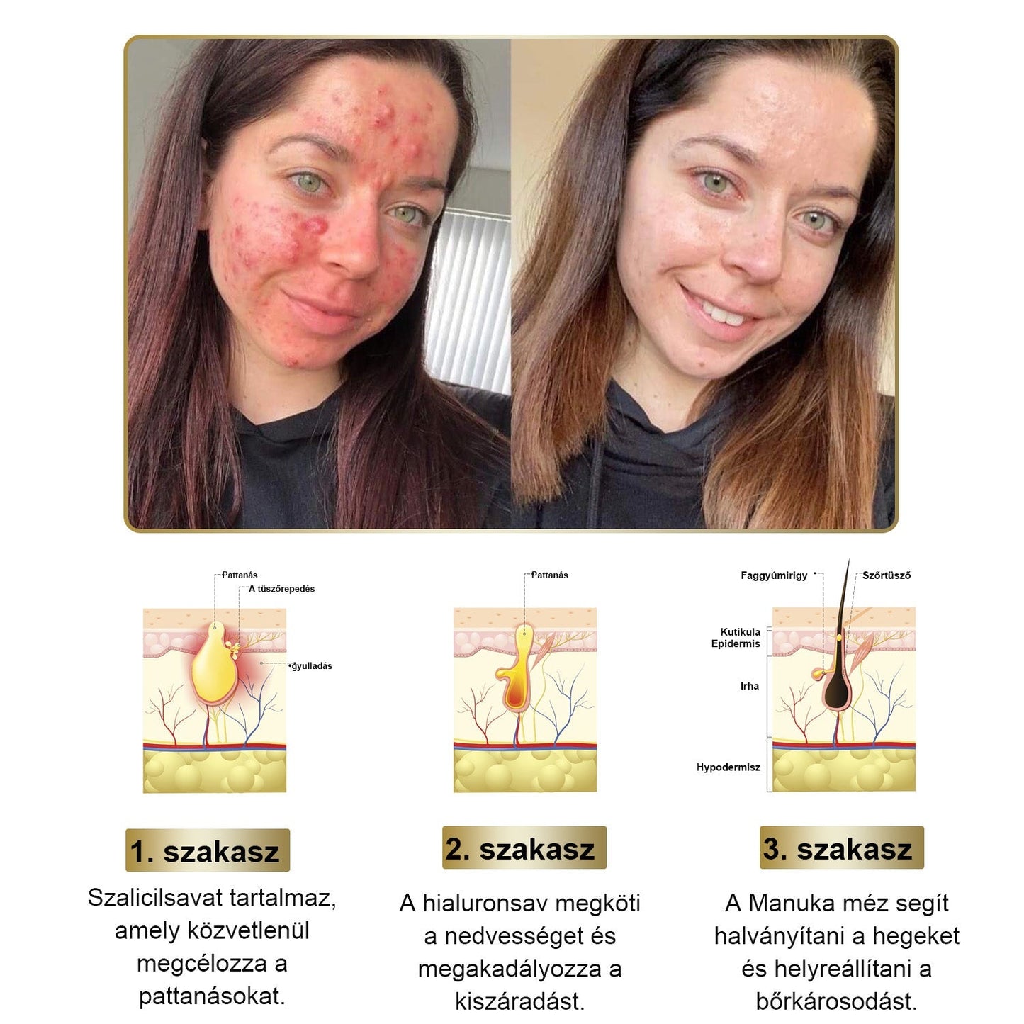 PLTOWE® Erőteljes egész testre ható bőrkezelő krém