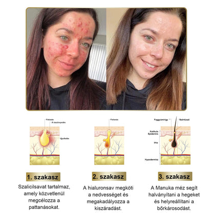 PLTOWE® Erőteljes egész testre ható bőrkezelő krém