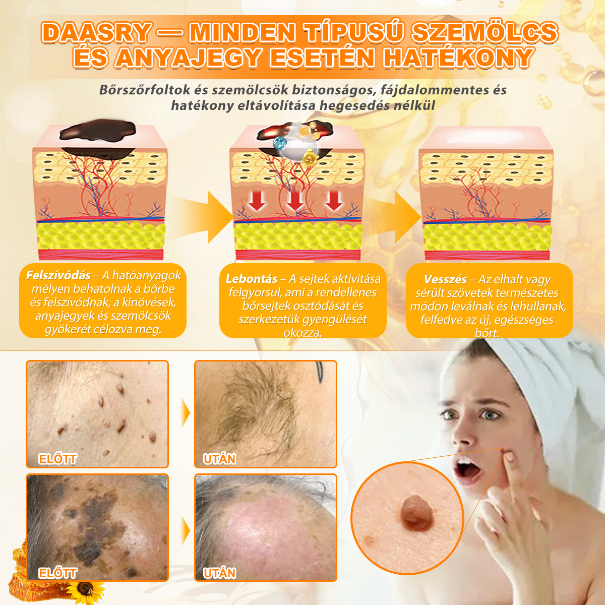 𝑫𝒂𝒂𝘀𝗿𝘆® 8-𝗮𝘇-𝟭-𝒃𝒆𝒏 𝑴é𝒉𝒎é𝒓𝒆𝒈 & 𝑭𝒂𝒈𝒈𝒚ú 𝑩ő𝒓𝒇𝒆𝒔𝒛𝒆𝒔í𝒕ő é𝒔 𝑹𝒆𝒈𝒆𝒏𝒆𝒓á𝒍ó 𝑲𝒓é𝒎