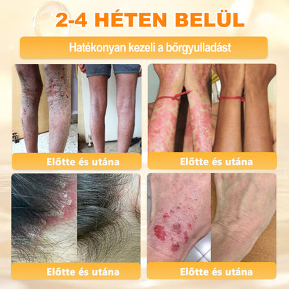 𝑫𝒂𝒂𝘀𝗿𝘆® 8-𝗮𝘇-𝟭-𝒃𝒆𝒏 𝑴é𝒉𝒎é𝒓𝒆𝒈 & 𝑭𝒂𝒈𝒈𝒚ú 𝑩ő𝒓𝒇𝒆𝒔𝒛𝒆𝒔í𝒕ő é𝒔 𝑹𝒆𝒈𝒆𝒏𝒆𝒓á𝒍ó 𝑲𝒓é𝒎