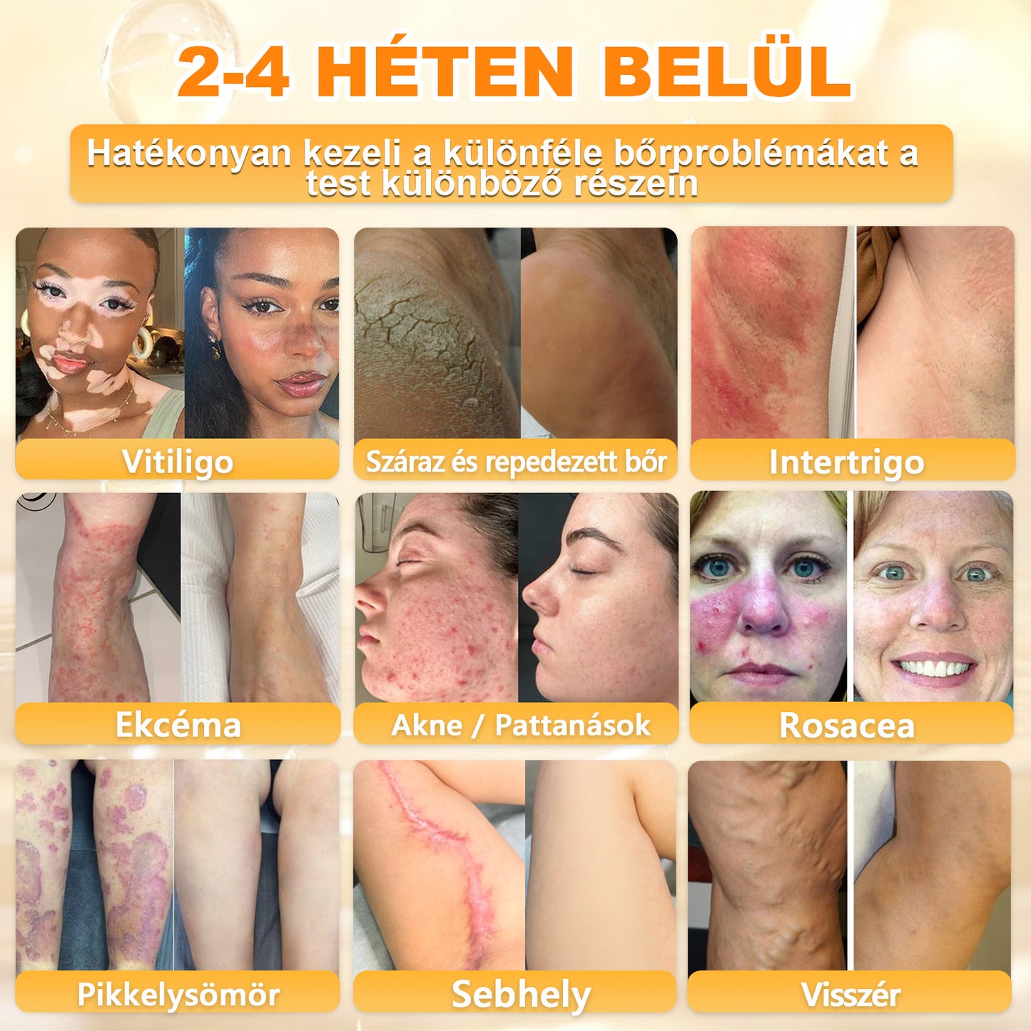 𝑫𝒂𝒂𝘀𝗿𝘆® 8-𝗮𝘇-𝟭-𝒃𝒆𝒏 𝑴é𝒉𝒎é𝒓𝒆𝒈 & 𝑭𝒂𝒈𝒈𝒚ú 𝑩ő𝒓𝒇𝒆𝒔𝒛𝒆𝒔í𝒕ő é𝒔 𝑹𝒆𝒈𝒆𝒏𝒆𝒓á𝒍ó 𝑲𝒓é𝒎