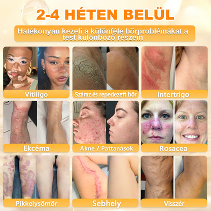 𝑫𝒂𝒂𝘀𝗿𝘆® 8-𝗮𝘇-𝟭-𝒃𝒆𝒏 𝑴é𝒉𝒎é𝒓𝒆𝒈 & 𝑭𝒂𝒈𝒈𝒚ú 𝑩ő𝒓𝒇𝒆𝒔𝒛𝒆𝒔í𝒕ő é𝒔 𝑹𝒆𝒈𝒆𝒏𝒆𝒓á𝒍ó 𝑲𝒓é𝒎