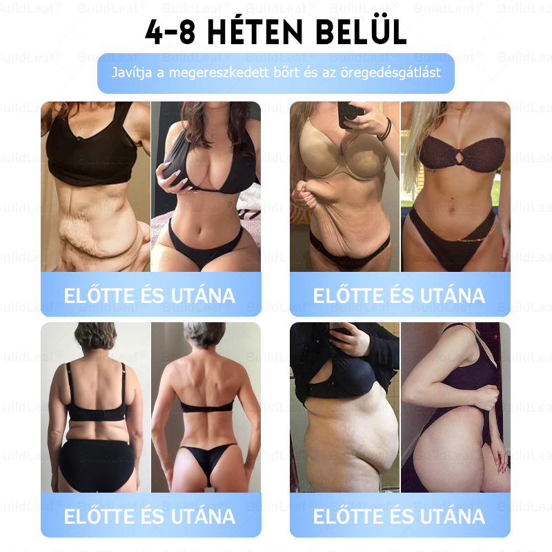 FDA Store | 𝐵uil𝗱𝐿ea𝐟® GLP-1 Slim & Firm Nano Microneedle Patch kollagénnel, kurkumával és Matrixyl 3000-rel | Elhízás, szív- és érrendszeri betegségek, cukorbetegség, alvási apnoe, ízületi problémák és egyéb állapotok kezelésére