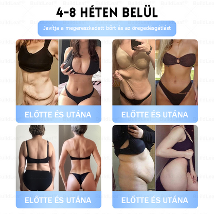 FDA Store | 𝐵uil𝗱𝐿ea𝐟® GLP-1 Slim & Firm Nano Microneedle Patch kollagénnel, kurkumával és Matrixyl 3000-rel | Elhízás, szív- és érrendszeri betegségek, cukorbetegség, alvási apnoe, ízületi problémák és egyéb állapotok kezelésére